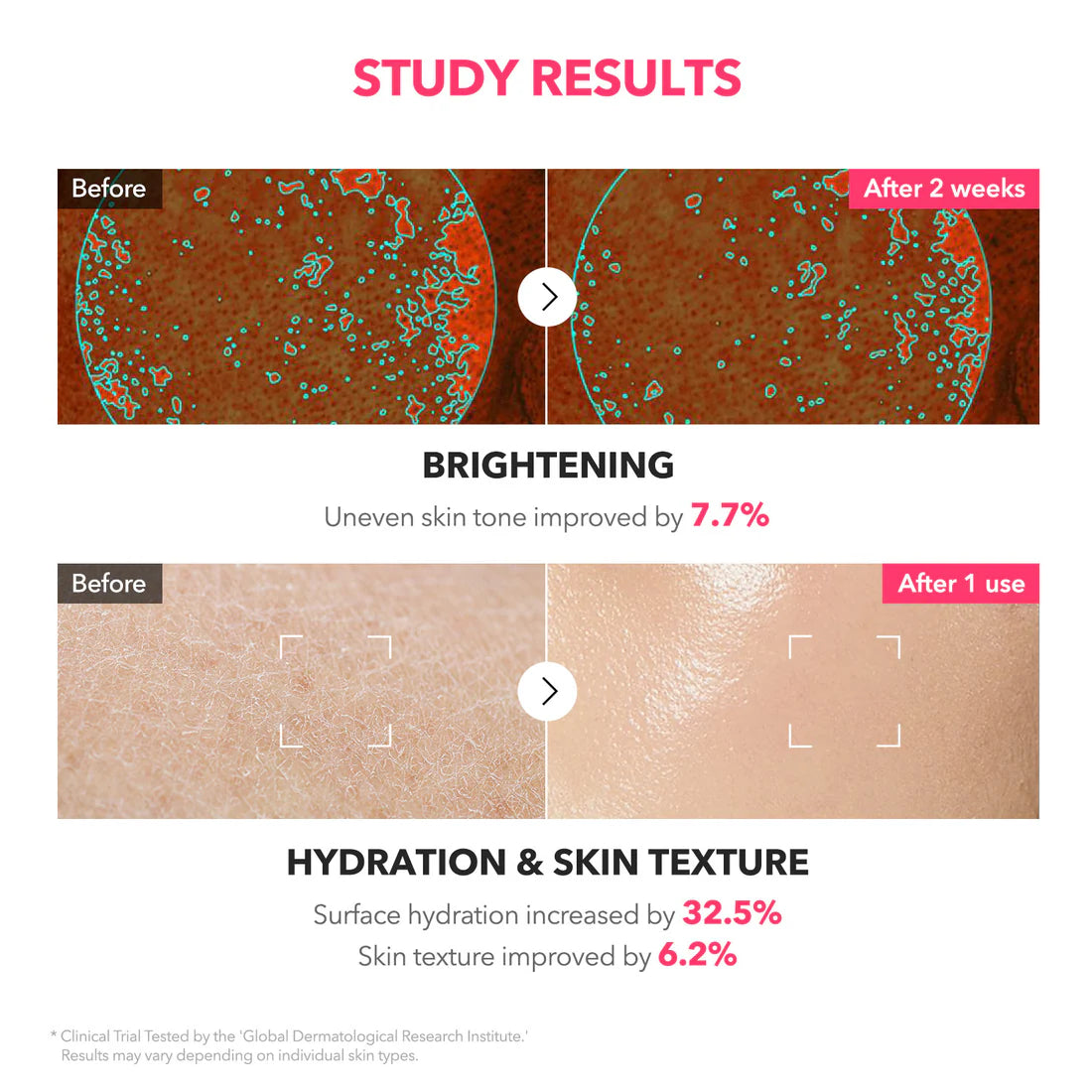 APRIL SKIN TXA+Niacinamide 99 Pink Milky Toner