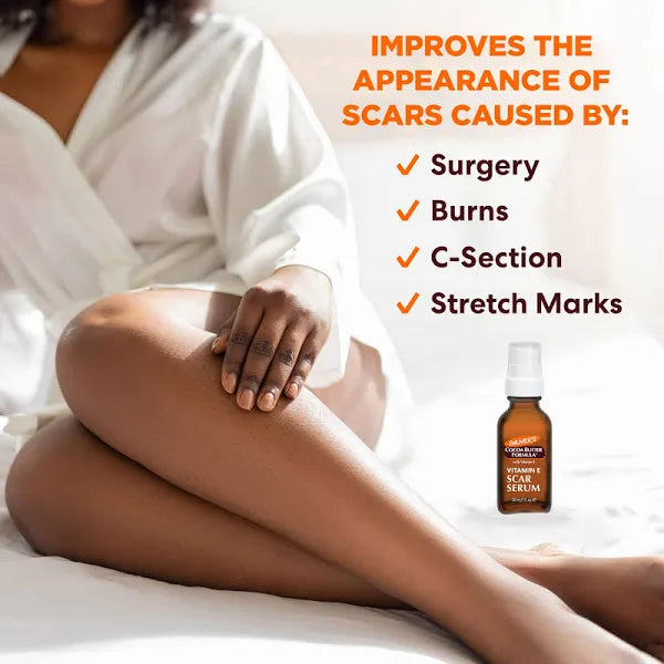 Palmer’s coco butter vitamin E scar serum