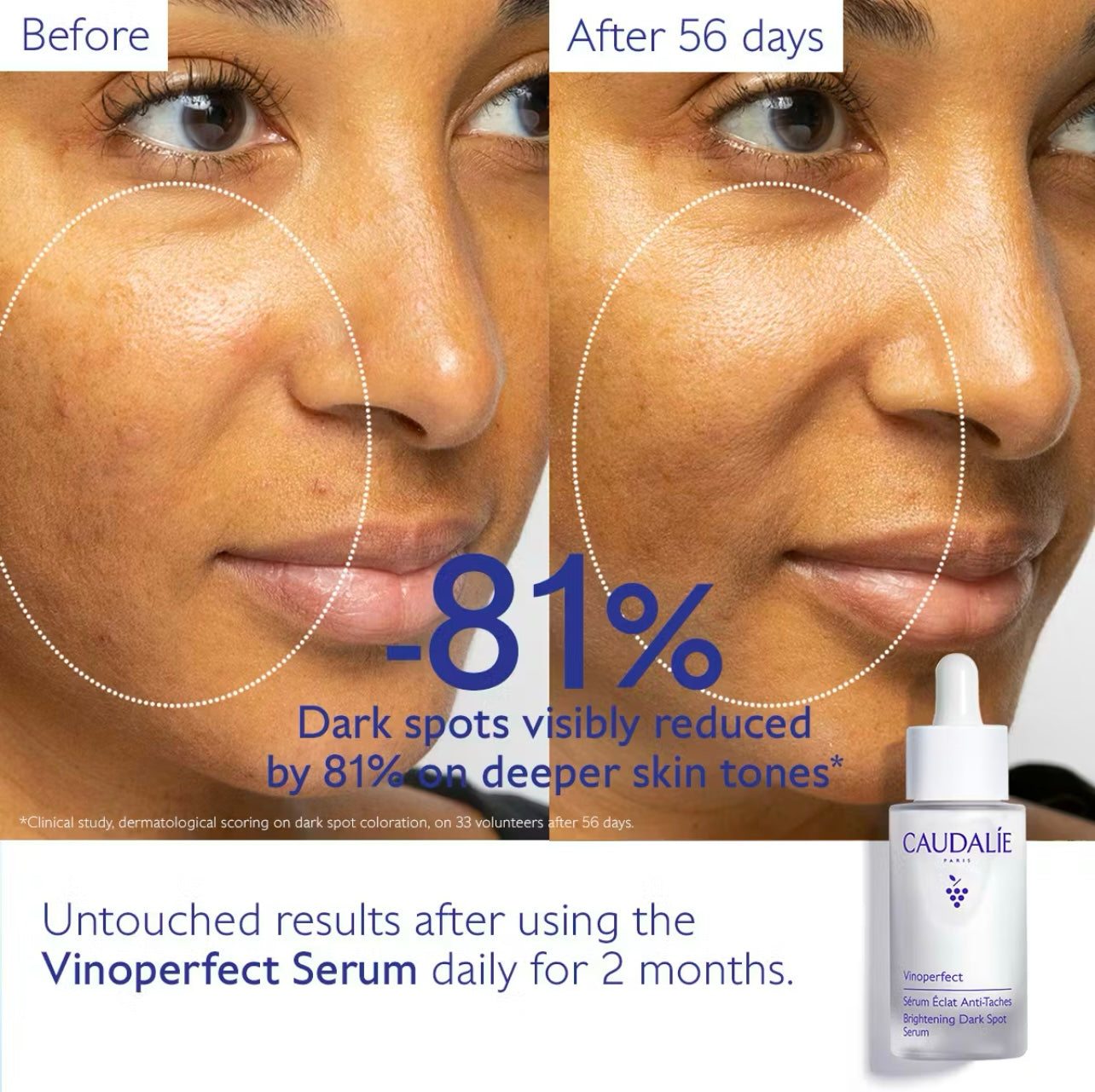 CAUDALIE Dark Spot Brightening Serum Vitamin C Alternative - 30ml