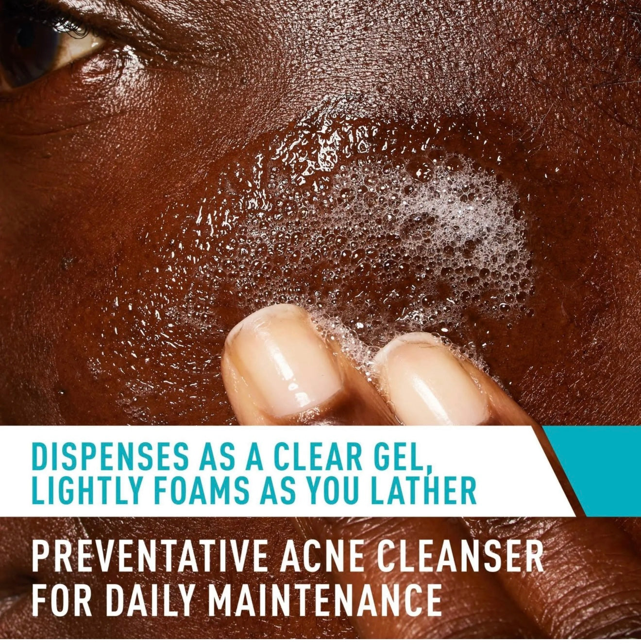 Cerave acne control cleanser