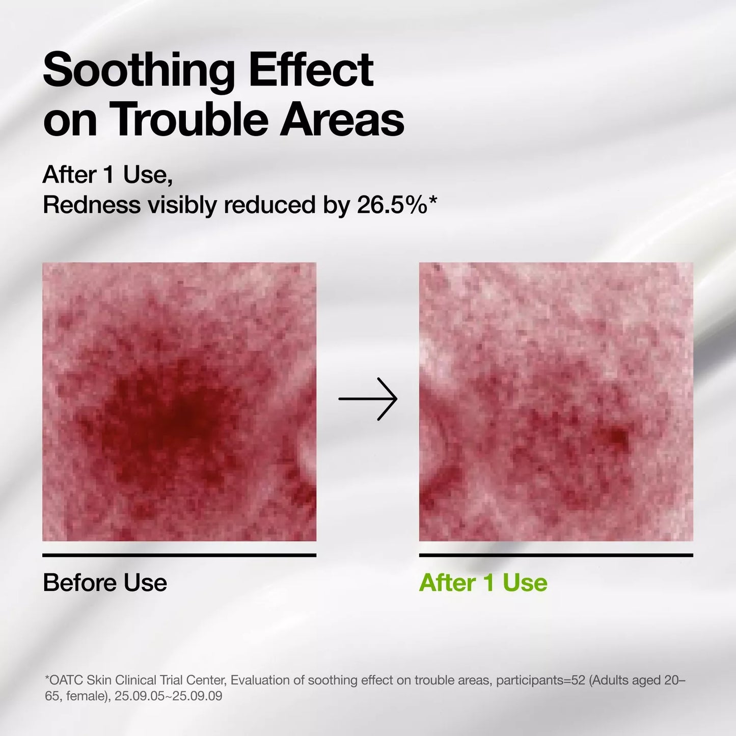 ANUA Azelaic Acid Cica Skin Soothing Moisturizer