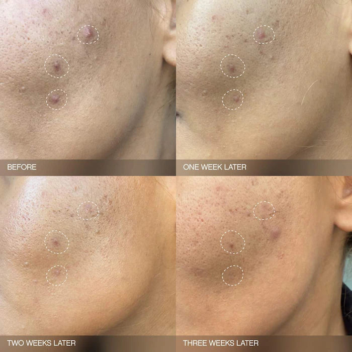 Topicals 
Faded Brightening Serum for Dark Spots and Discoloration 15ml