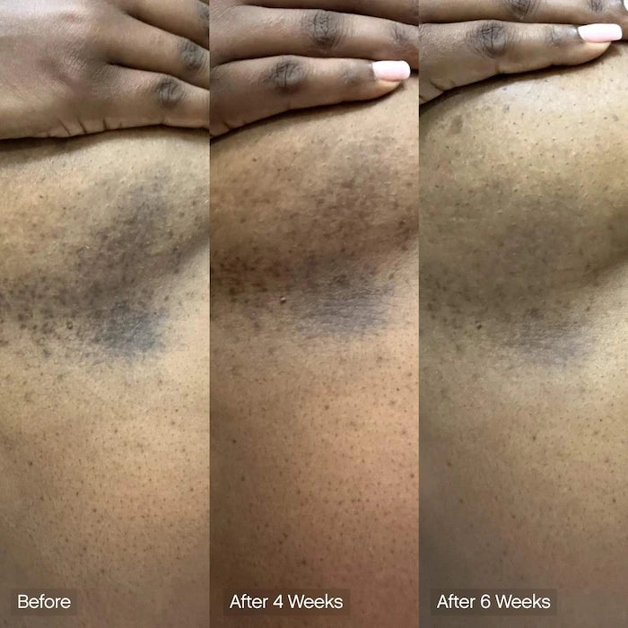 Topicals 
Faded Brightening & Cleansing Body Bar for Uneven Skin Tone (2 Pack)