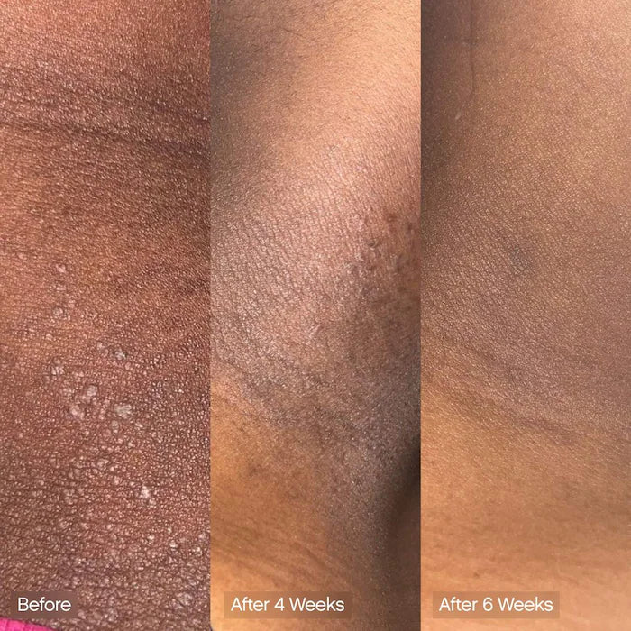 Topicals 
Faded Brightening & Cleansing Body Bar for Uneven Skin Tone (2 Pack)