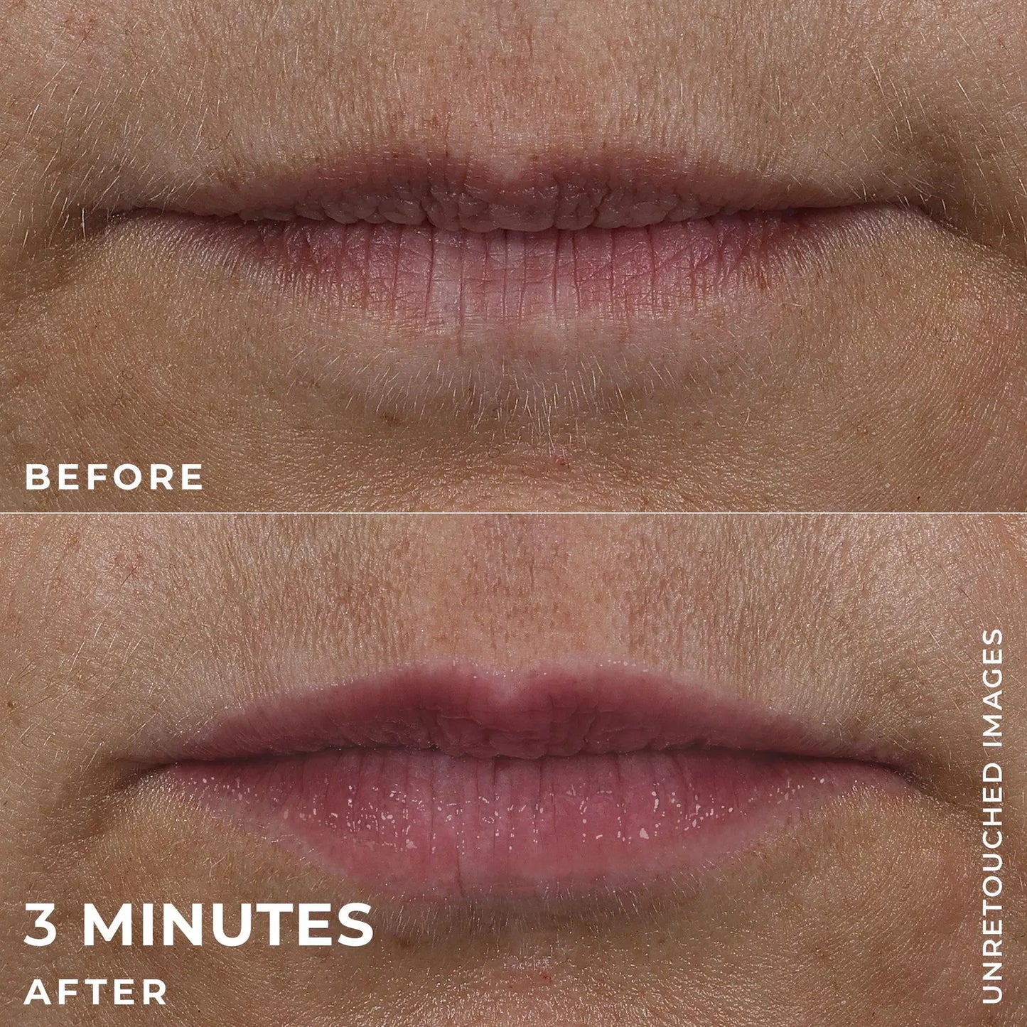 Roc Derm Correxion Lip Volumizer