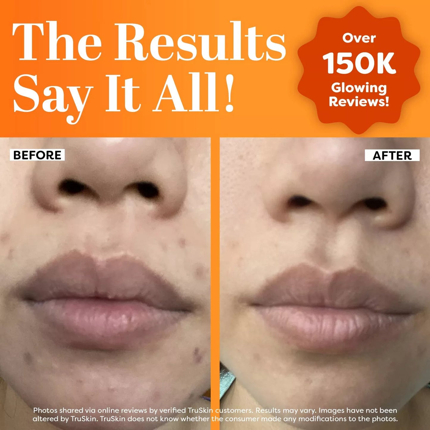 Tru skin vitamin c serum