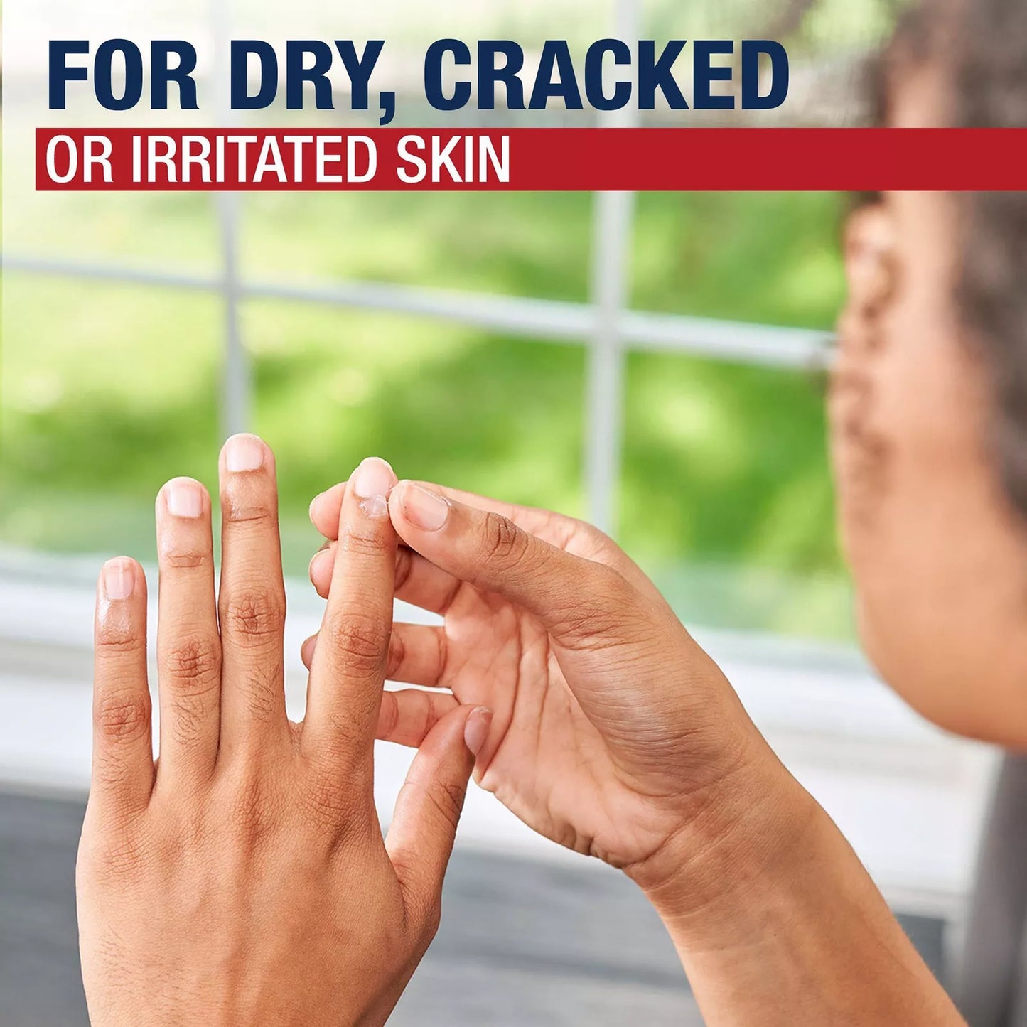 Aquaphor Healing Ointment 14 oz