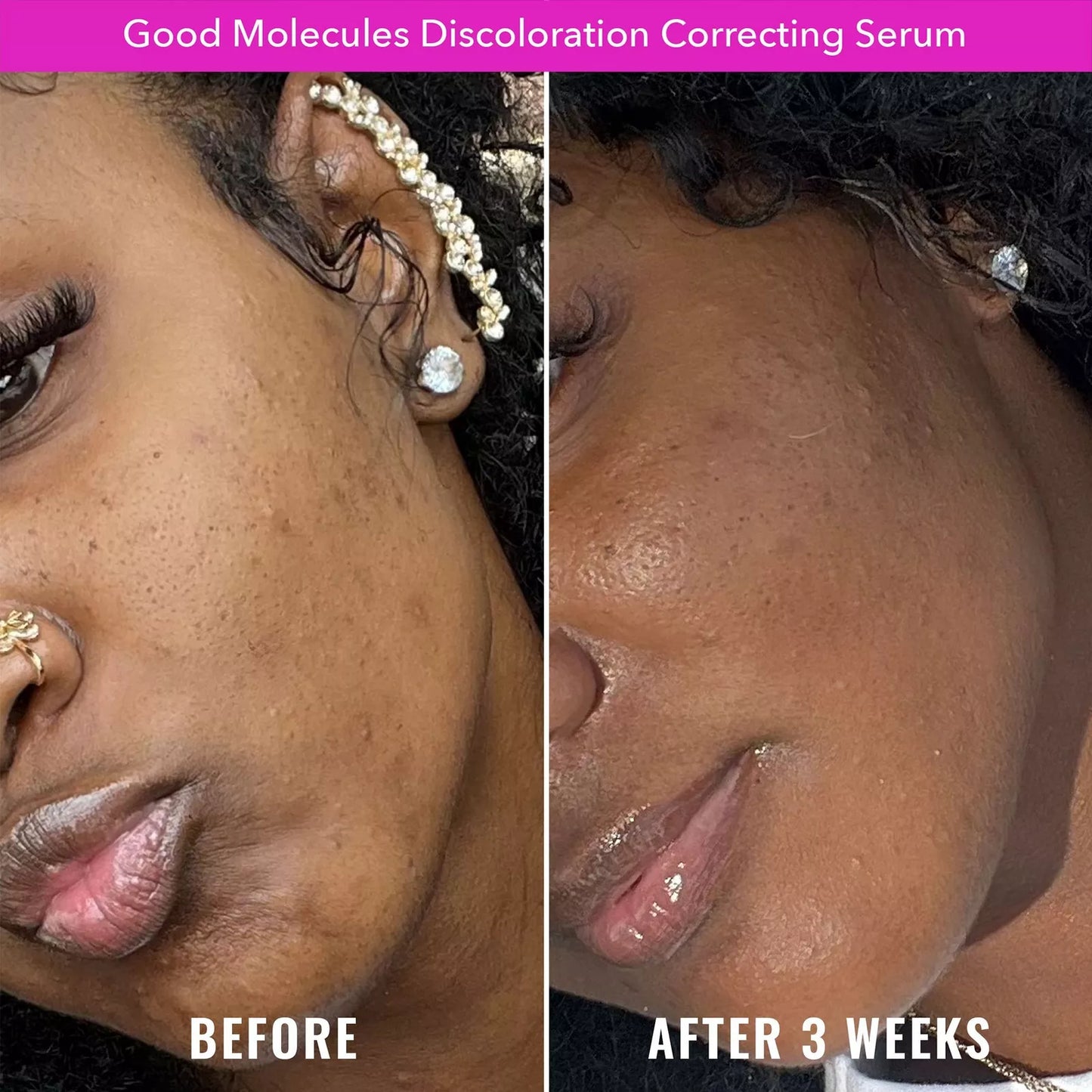 Good Molecules Discoloration Correcting Serum